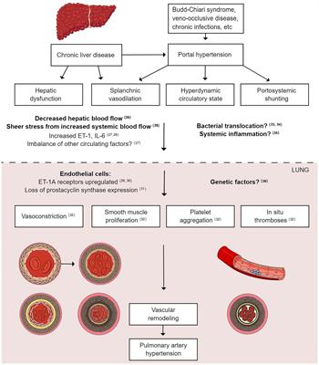 Current clinical understanding and effectiveness of portopulmonary hypertension treatment